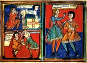 Medieval surgery